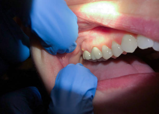 Best Pediatric Emergency Dentist in Mountain City, GA