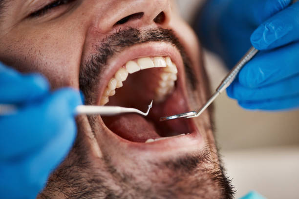 Best Urgent Care for Lost Fillings or Crowns in Mountain City, GA