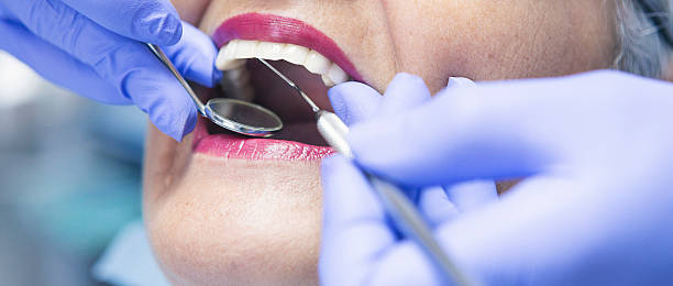 Best Emergency Treatment for Dental Infections or Abscesses in Mountain City, GA